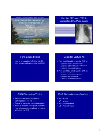 Use the EKG and CXR to  Perioperative Electrophysiology:  understand the Pacemaker  Perioperative