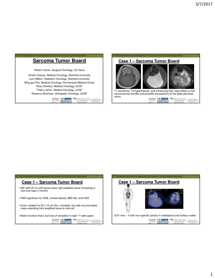 sarcoma tumor board