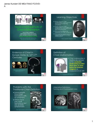 Visual Consequences of u Which cause of Chiari  malformation is not evident with  imagining, but