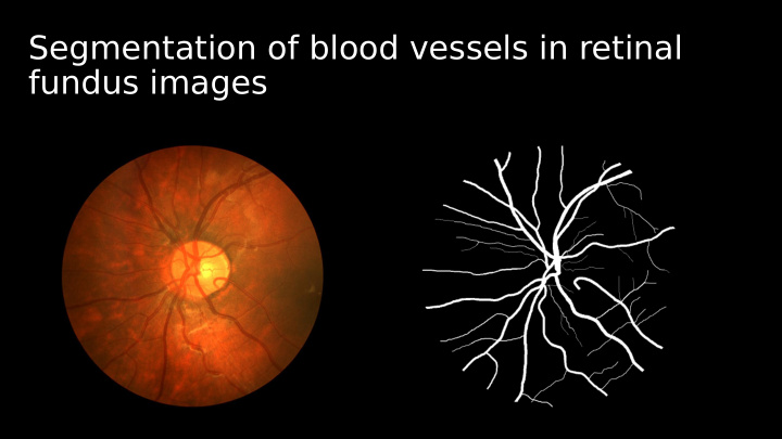segmentation of blood vessels in retinal fundus images