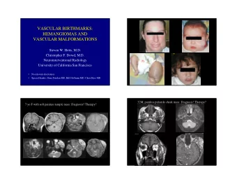 VASCULAR BIRTHMARKS:  HEMANGIOMAS AND  VASCULAR MALFORMATIONS  Steven W. Hetts, M.D.  Christopher