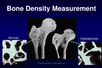 Bone Density Measurement  Normal  Normal  Osteoporosis  Osteoporosis  Chalermchai Apinyanurug  Who