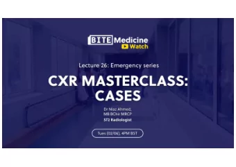 Lung Anatomy  Anterior  Posterior  Right  Left  2  Approaching a CXR  1.  Patient and clinical