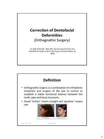 Correction of Dentofacial  Deformities  (Orthognathic Surgery)  Dr. Rafik Al Kowafi   BDS, MSc,