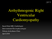 arrhythmogenic right ventricular cardiomyopathy