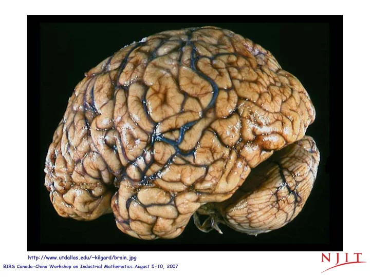 http utdallas edu kilgard brain jpg