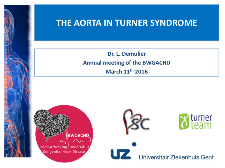 the aorta in turner syndrome