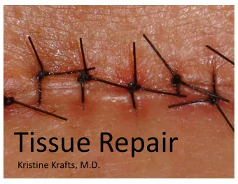 Tissue Repair  Kristine Krafts, M.D.  Tissue Repair Lecture Objectives  Define tissue repair,