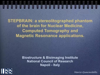 STEPBRAIN: a stereolitographed phantom  of the brain for Nuclear Medicine,  Computed Tomography and
