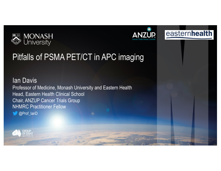 pitfalls of psma pet ct in apc imaging