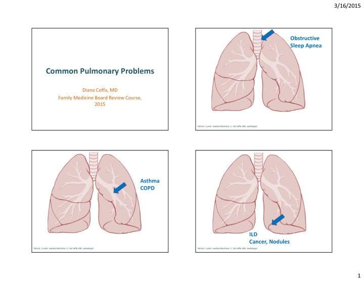 common pulmonary problems