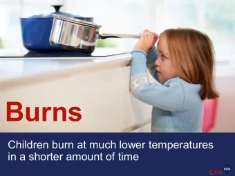 Burns  Children burn at much lower temperatures  in a shorter amount of time  Children are  more