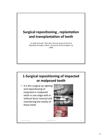 Surgical repositioning , replantation  and transplantation of teeth  Dr. Rafik Al Kowafi   BDS,