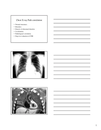 Chest X-ray Path correlation   Normal structures   Densities   Genesis of abnormal
