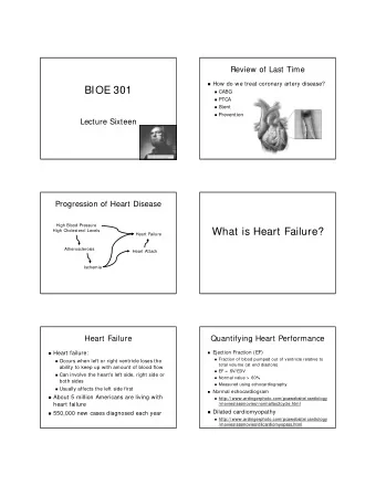 BIOE 301  CABG  PTCA  Stent  Prevention  Lecture Sixteen  Progression of Heart Disease