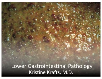 Lower Gastrointestinal Pathology  Kristine Krafts, M.D.  GI Pathology Outline  Esophagus