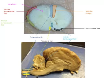 spinocerebellar  tract  Vestibulospinal tract  Anterior  Fasciculus Gracilis  Corticospinal Tract