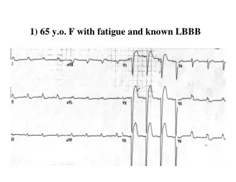 1) 65 y.o. F with fatigue and known LBBB  1) 65 y.o F with known LBBB - baseline  2) 86 F with
