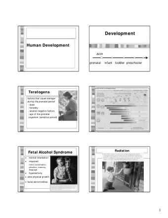 Development  Human Development  birth  prenatal    infant   toddler  preschooler  Teratogens