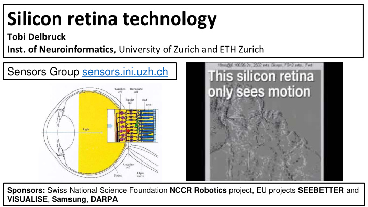 silicon retina technology