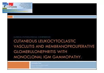CUTANEOUS LEUKOCYTOCLASTIC  VASCULITIS AND MEMBRANOPROLIFERATIVE  GLOMERULONEPHRITIS WITH