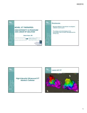 8/9/2016  Disclosures  Biosense-Webster International: investigator-  NOVEL VT THERAPIES: