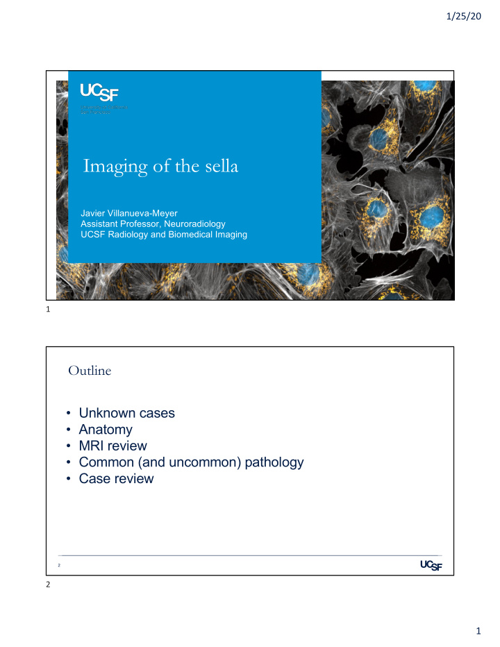 imaging of the sella
