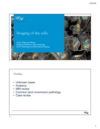 Imaging of the sella  Javier Villanueva-Meyer  Assistant Professor, Neuroradiology  UCSF Radiology