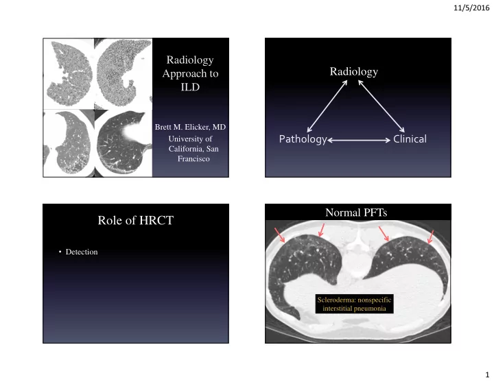role of hrct