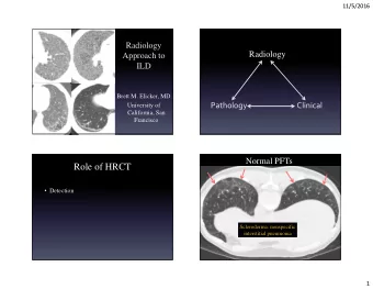 Role of HRCT  Detection  Scleroderma: nonspecific  interstitial pneumonia  1  11/5/2016  End
