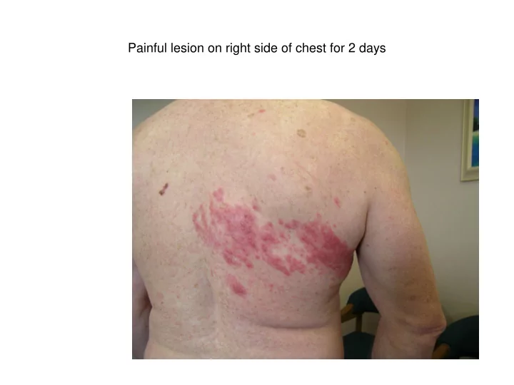 painful lesion on right side of chest for 2 days