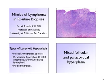 Mimics of Lymphoma  in Routine Biopsies  Patrick Treseler, MD, PhD  Professor of Pathology