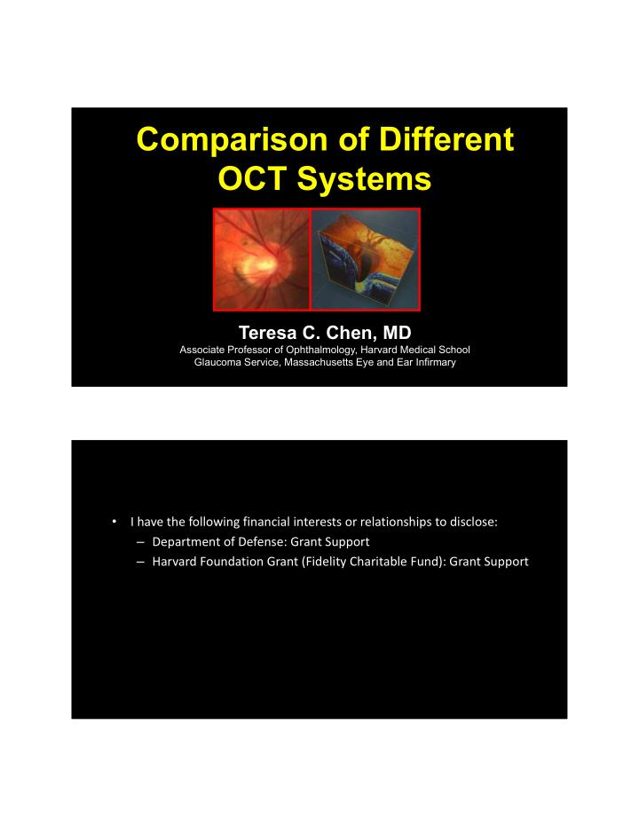 comparison of different oct systems