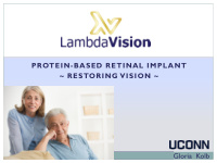 gloria kolb need for retinal implants retinal