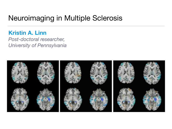 neuroimaging in multiple sclerosis