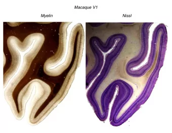 Allman &amp; Kaas, 1981  Zeki,