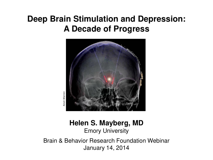 deep brain stimulation and depression