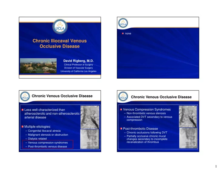 chronic iliocaval venous occlusive disease