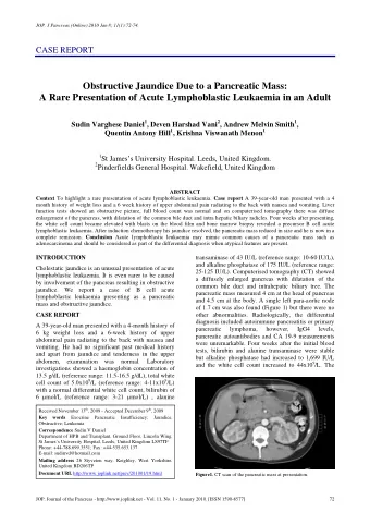 Obstructive Jaundice Due to a Pancreatic Mass:  A Rare Presentation of Acute Lymphoblastic