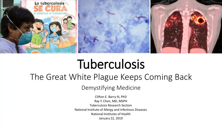 tuberculosis