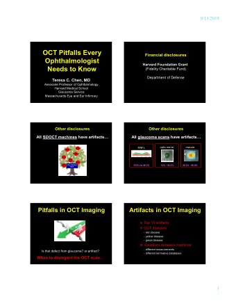 OCT Pitfalls Every  Financial disclosures  Ophthalmologist  Harvard Foundation Grant  Needs to Know