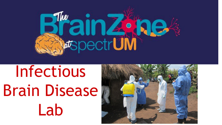 infectious brain disease lab what is the coolest thing