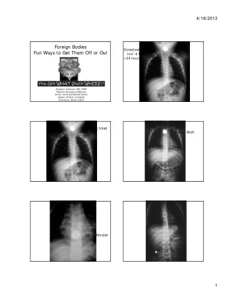 Foreign Bodies  Complications:  Fun Ways to Get Them Off or Out Incr  d Risk if  &gt; 24 hours