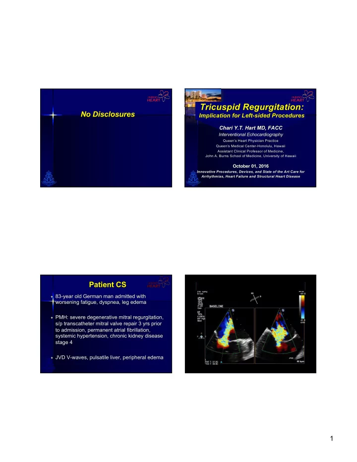 tricuspid regurgitation