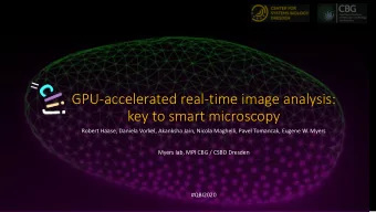 GPU-accelerated real-time image analysis:  key to smart microscopy  Robert Haase, Daniela Vorkel,