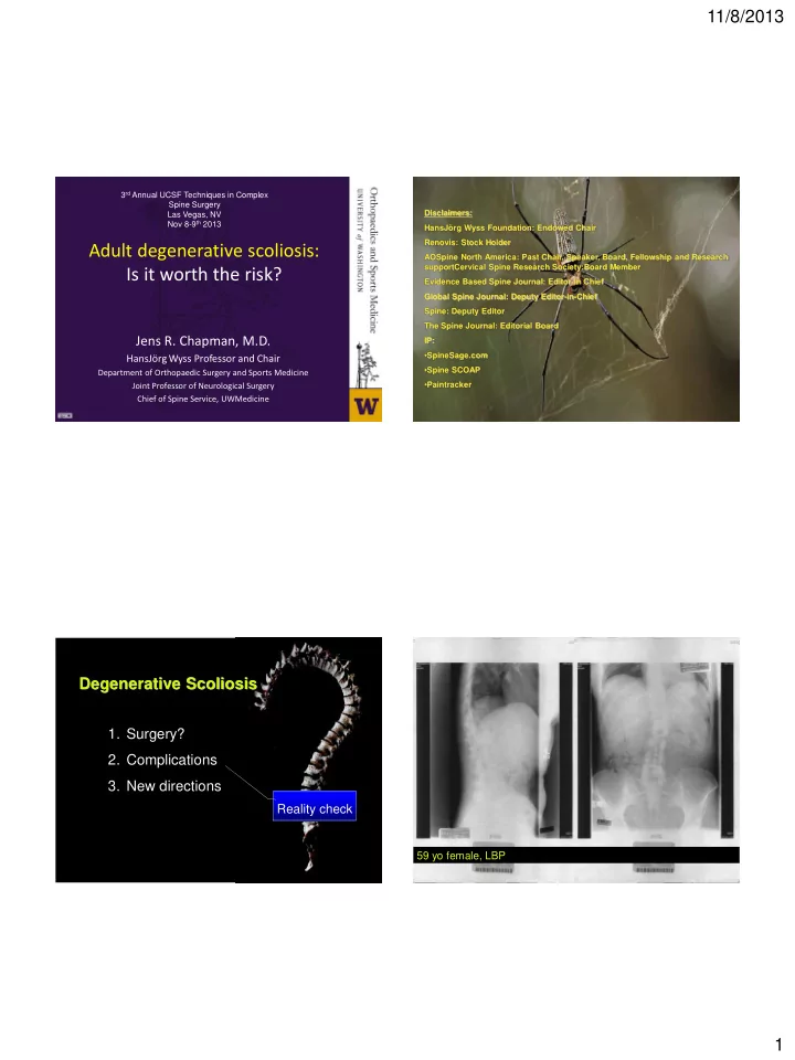 adult degenerative scoliosis