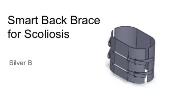 Smart Back Brace  for Scoliosis  Silver B  Product Vision  Traditional  Smart Back  Scoliosis