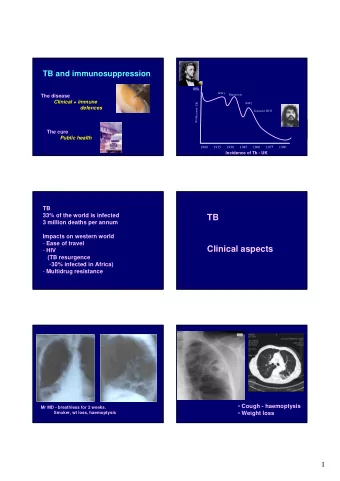 TB  3 million deaths per annum  Impacts on western world - Ease of travel  Clinical aspects - HIV