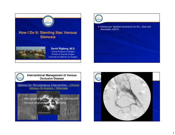 how i do it stenting iliac venous stenosis