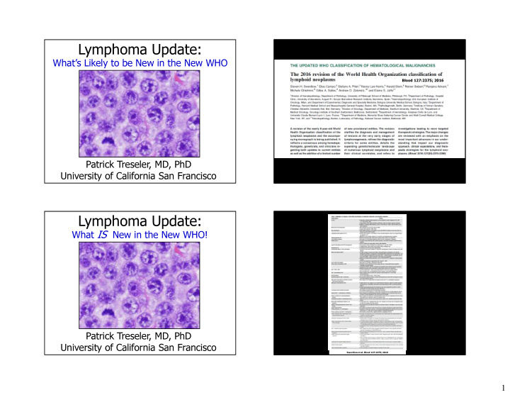 lymphoma update
